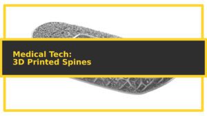 featuredimage 3d printed spine