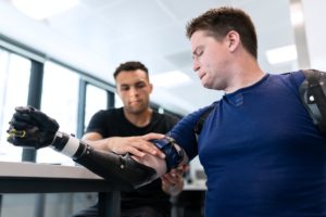 prosthetic arm